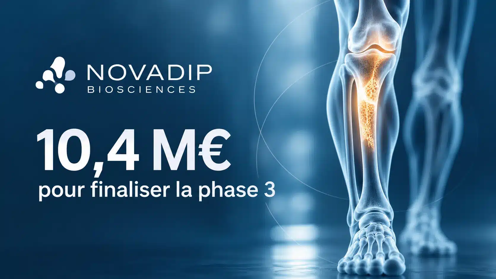 Novadip lève 10,4M€